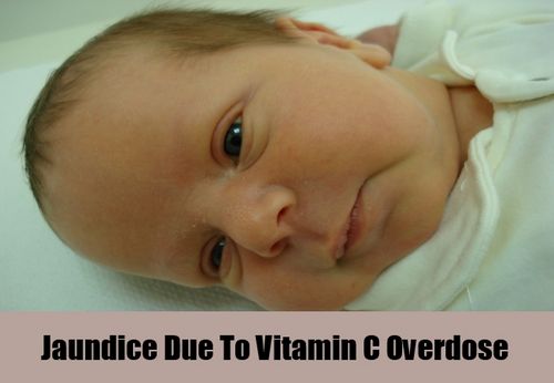 Vitamin B12 Overdose - What to Do 