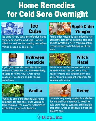 Some Cold Sore Remedies That Actually Work